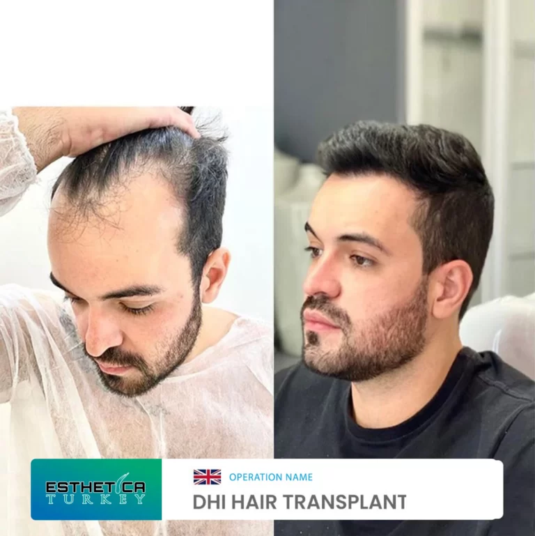 ESTHETİCA before after (9)