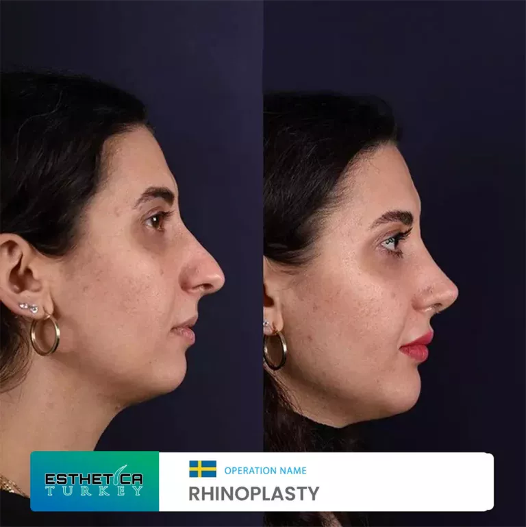 esthetica before after face estetic (10)