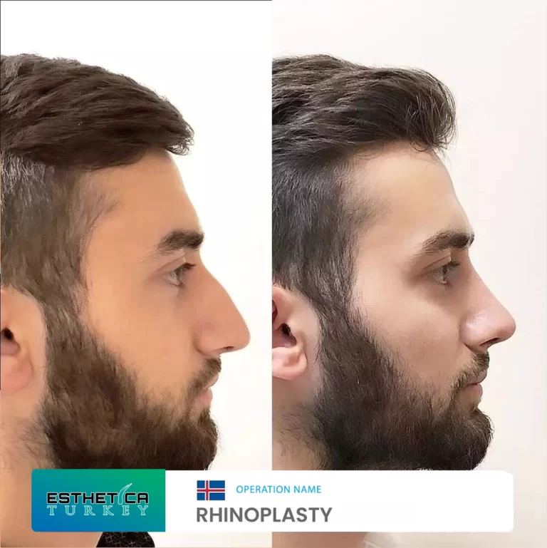 esthetica before after face estetic (11)