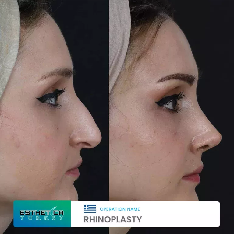 esthetica before after face estetic (12)