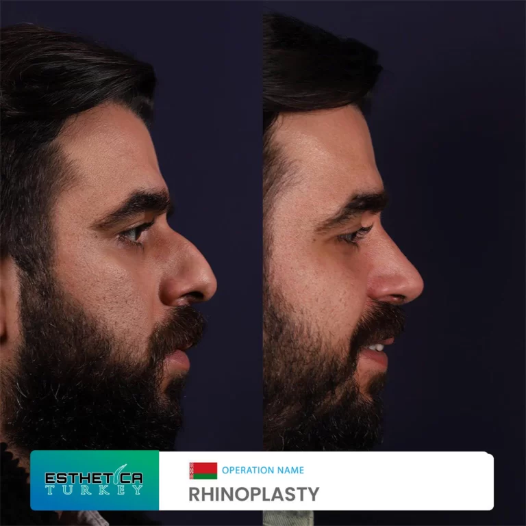 esthetica before after face estetic (13)