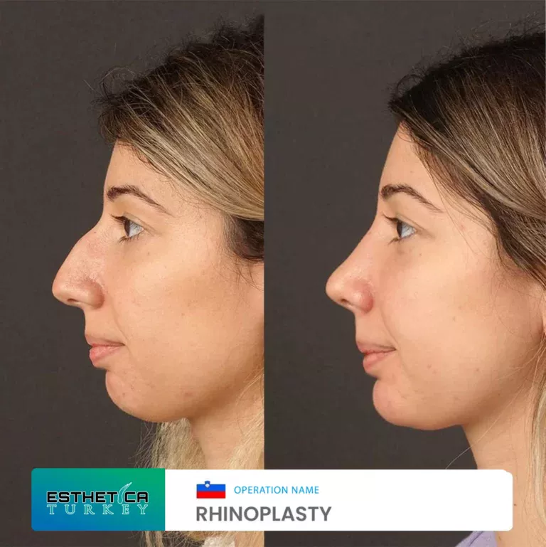 esthetica before after face estetic (3)