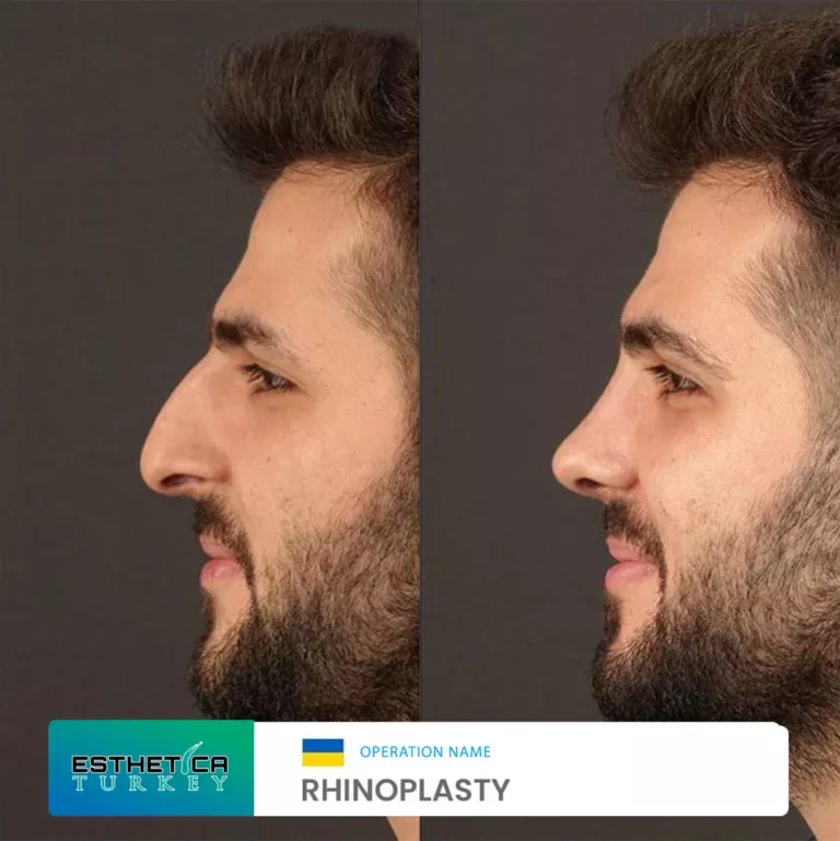 esthetica before after face estetic (4)