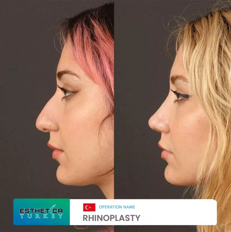 esthetica before after face estetic (5)