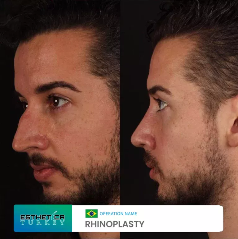 esthetica before after face estetic (6)
