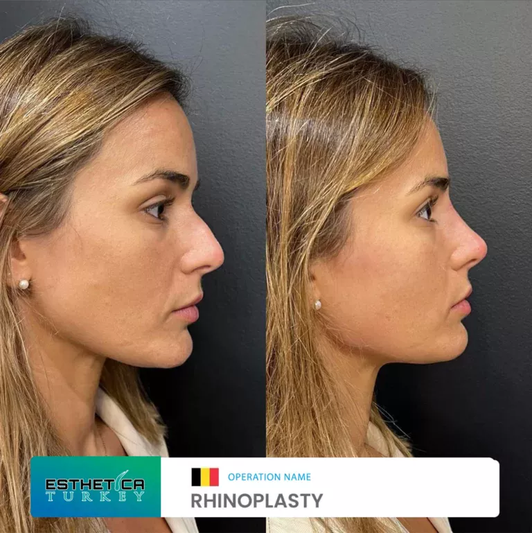 esthetica before after face estetic (7)