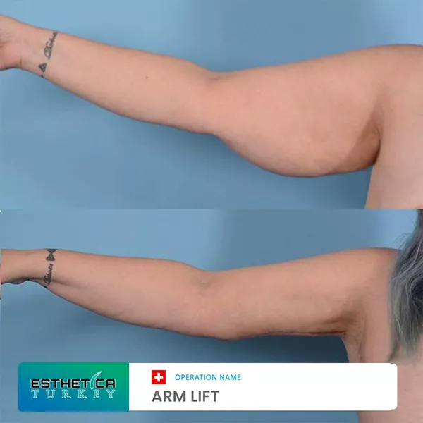 estetica plastic surgery before after (10)