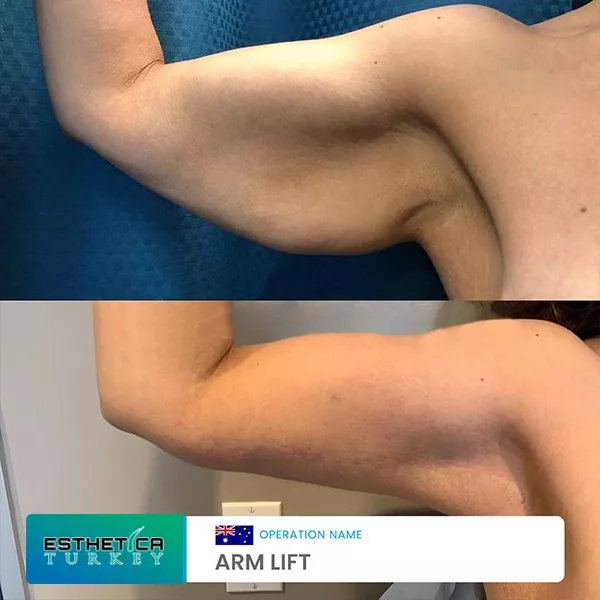 estetica plastic surgery before after (18)