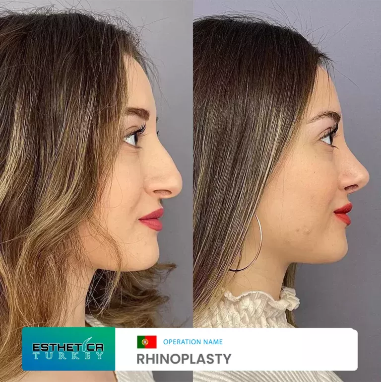 esthetica before after face estetic (9)
